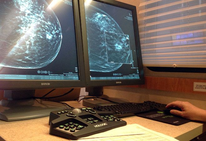 3-D mammograms improve breast cancer detection