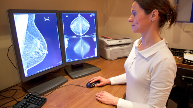 Researchers: Mammography screening should be individualized