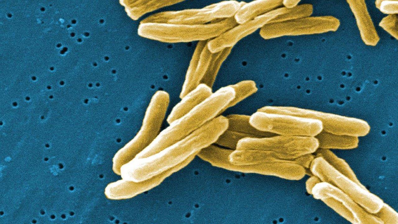 Is tuberculosis making a comeback?