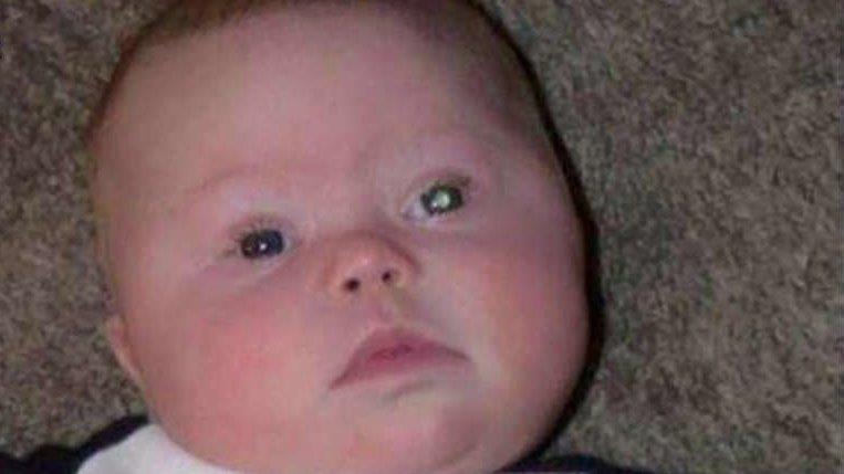 Camera flash detects baby's eye cancer