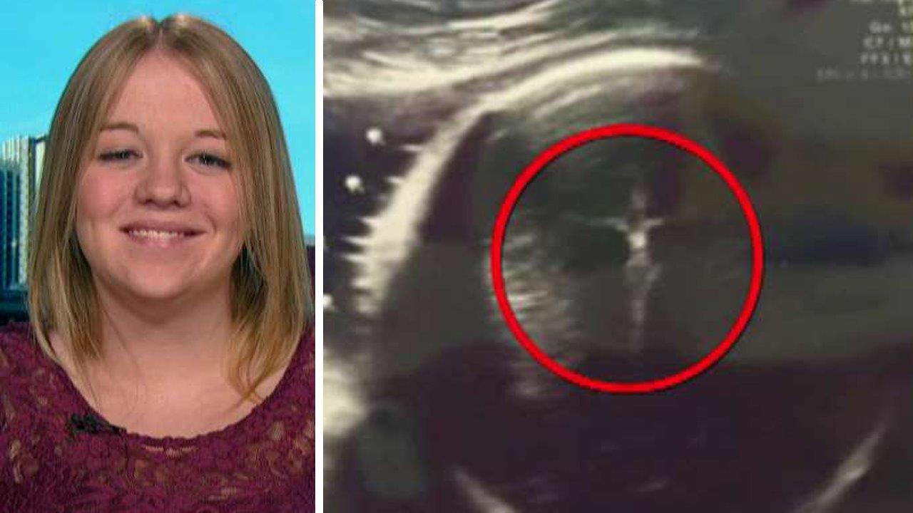 Mother-to-be sees Christ on the cross in sonogram image
