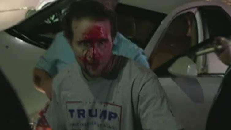 Trump supporter's face bloodied as protest turns chaotic