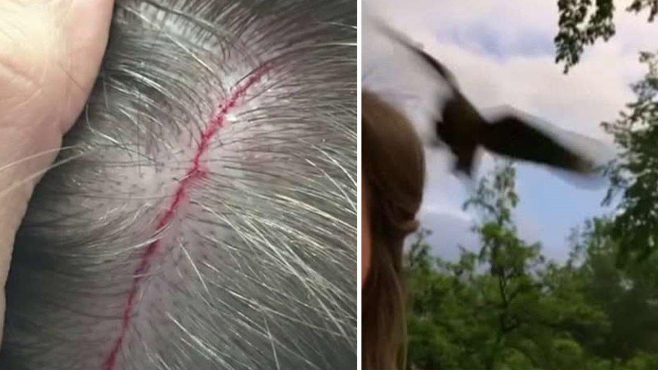Ouch! Hawk dive-bombs student