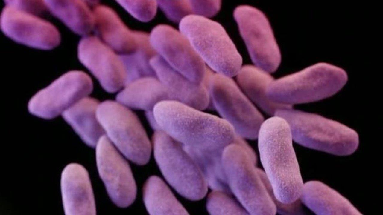 Deadly antibiotic-resistant superbug arrives in US