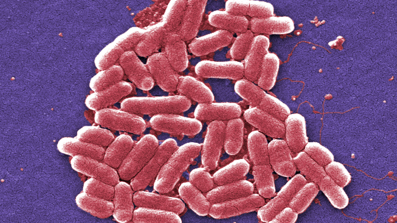 Deadly superbug could be spell end of antibiotics