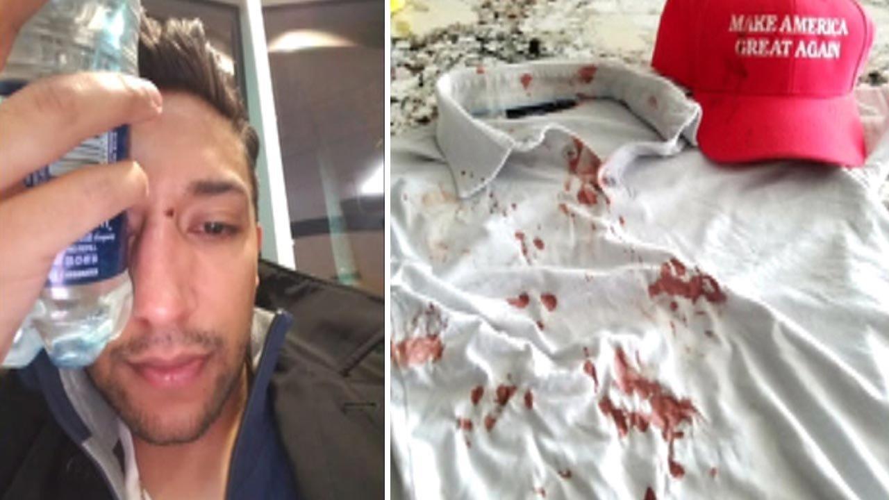 Latino Trump supporter says he was beaten by protesters