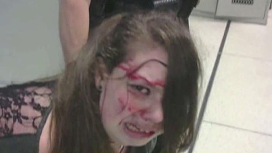 TSA agents allegedly assault disabled teen cancer patient