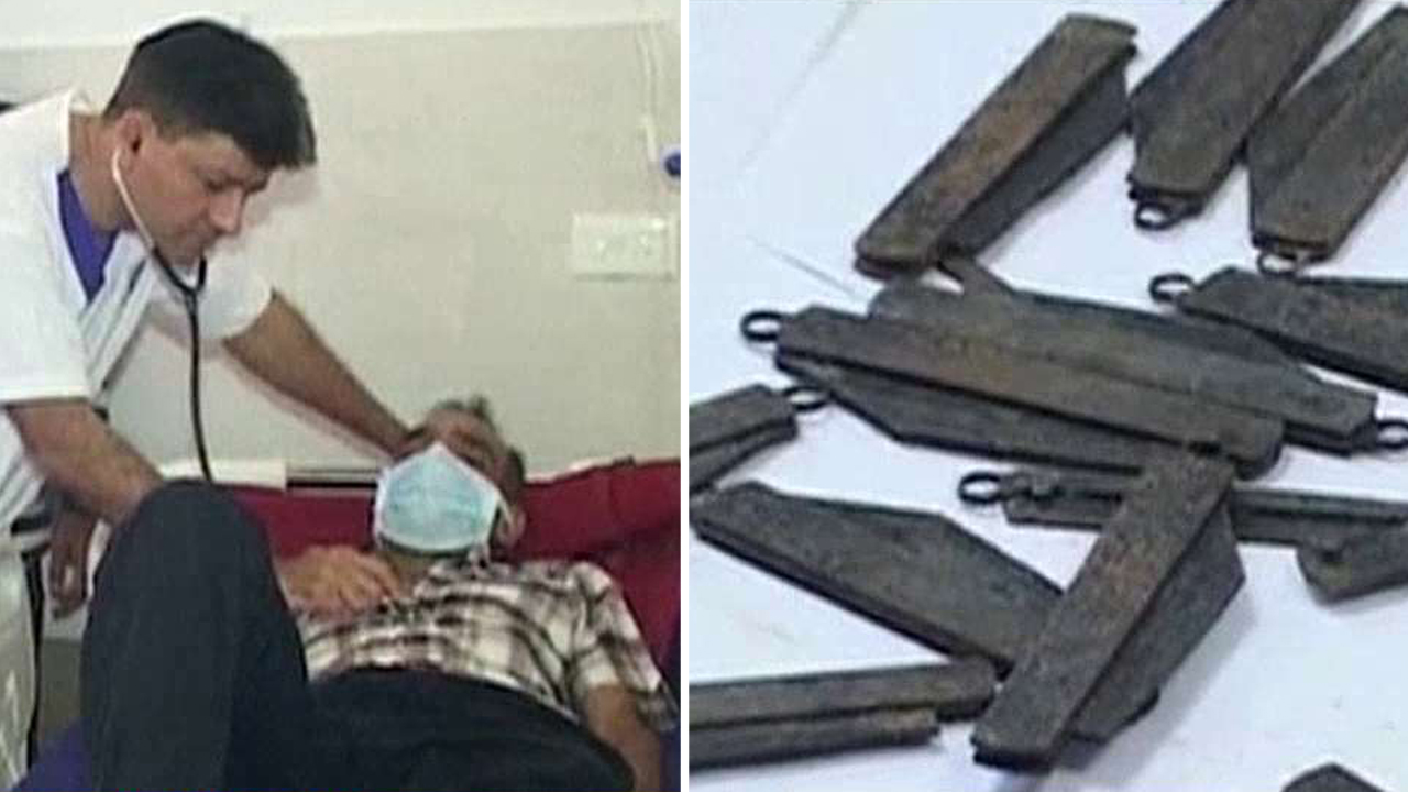 Doctors remove 40 knives from man's stomach