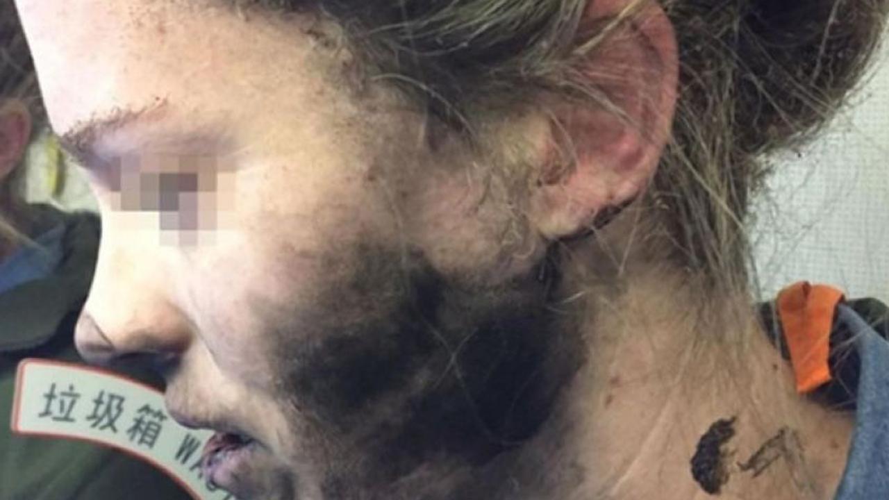 Headphones explode on woman's face during flight
