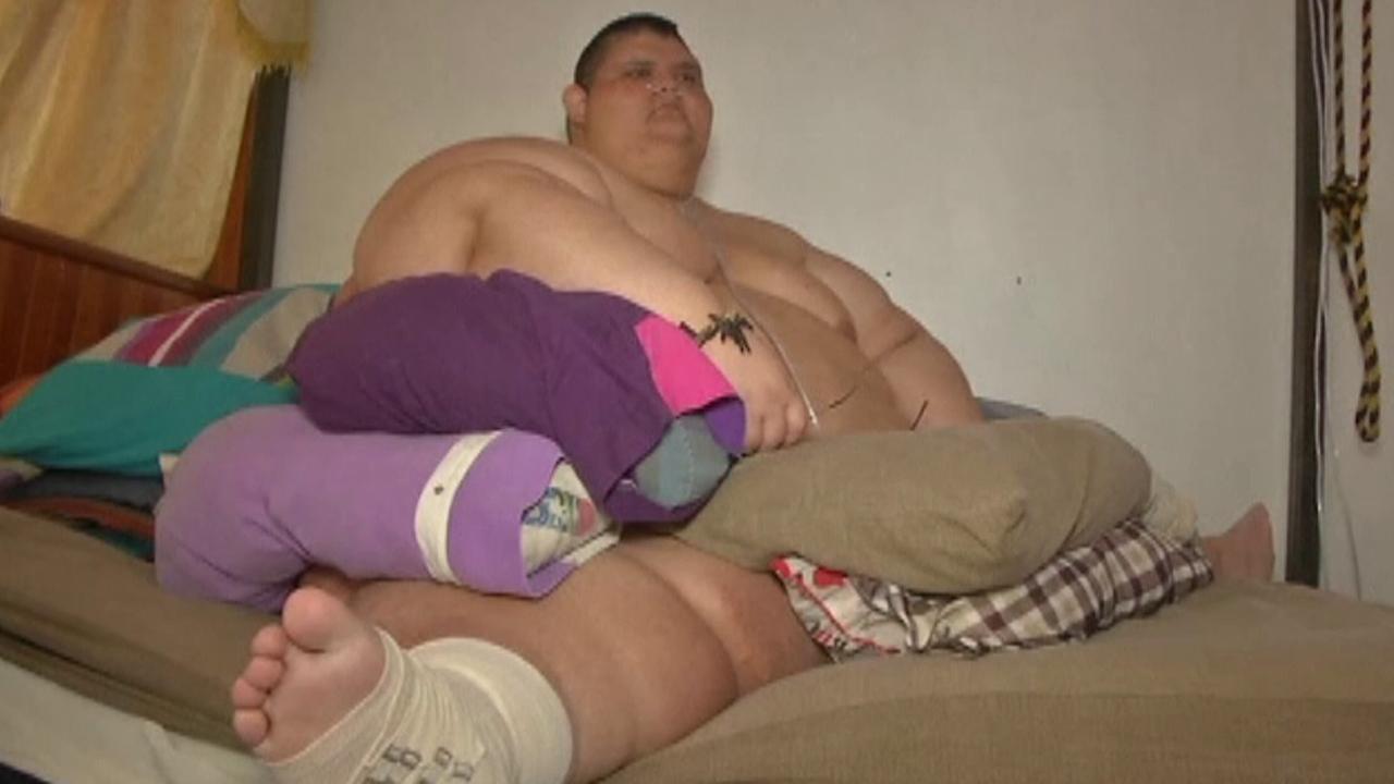 Surgery set for world's most obese man