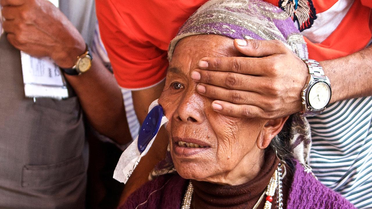 Doctors stop preventable blindness in developing nations