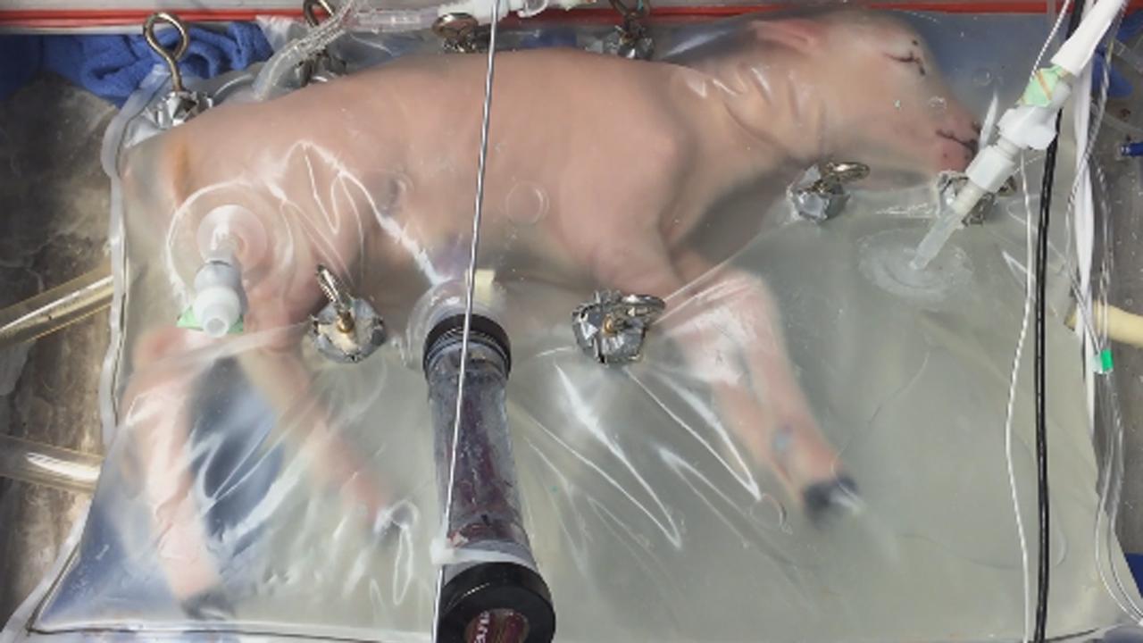 Artificial womb might one day help premature babies