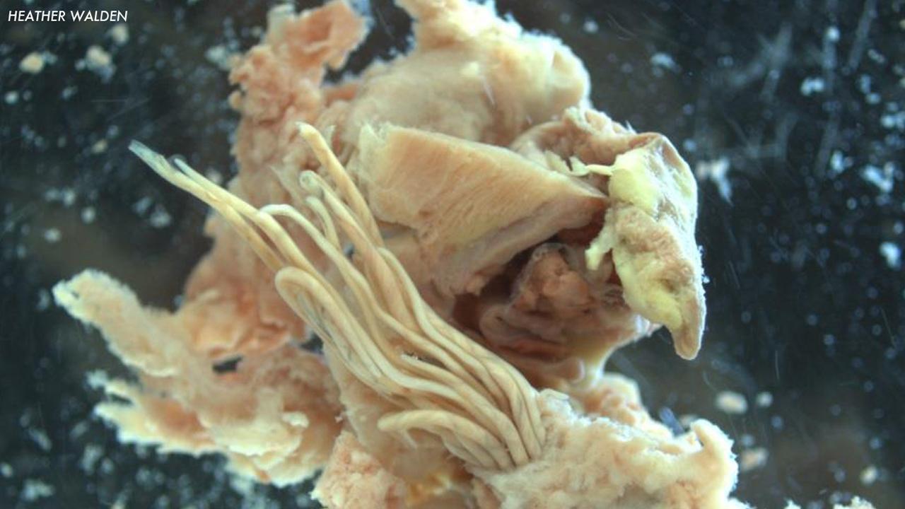 What is rat lungworm?