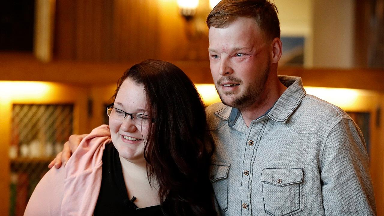 Face transplant recipient meets donor's widow 