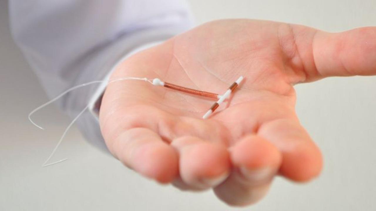 Study: IUDs may help to reduce women's cancer risk