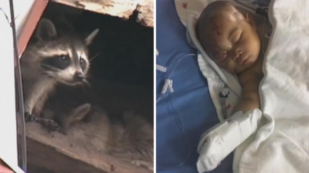 Raccoon attacks toddler in apartment causing serious injures
