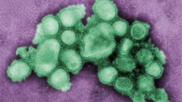 Doctors warn of 'second wave of flu'