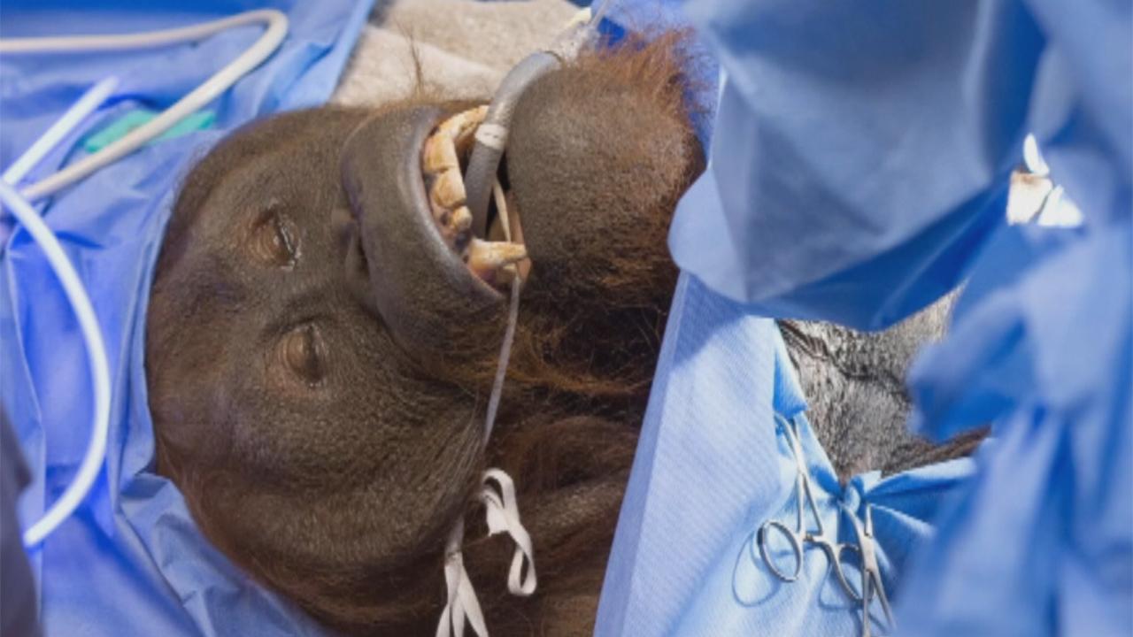 Orangutan gets surgery to clear up sinus infection