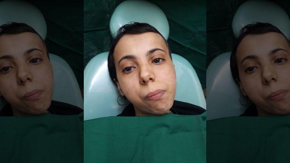 Woman who couldn't open her mouth for 30 years is finally able to chew