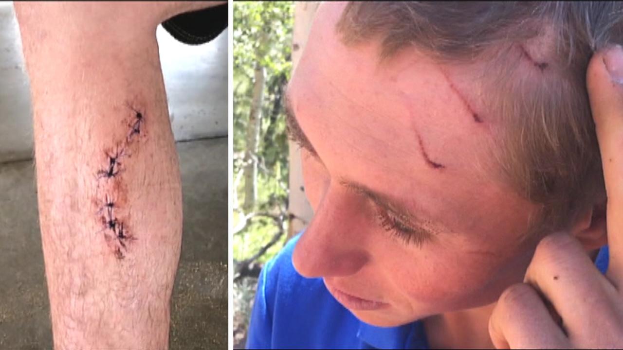 Ouch! Man bitten by shark, bear, snake in less than 4 years