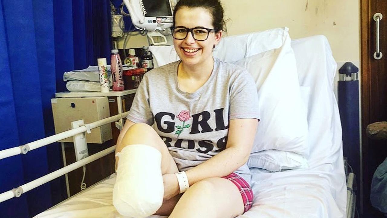 A young woman has her leg amputated after a fracture wouldn't heal