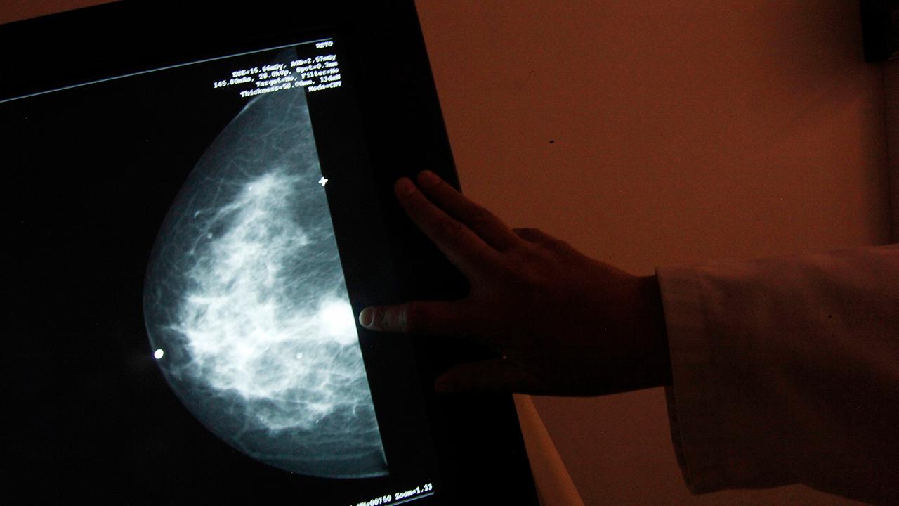 UK faces backlash over breast cancer screening failures
