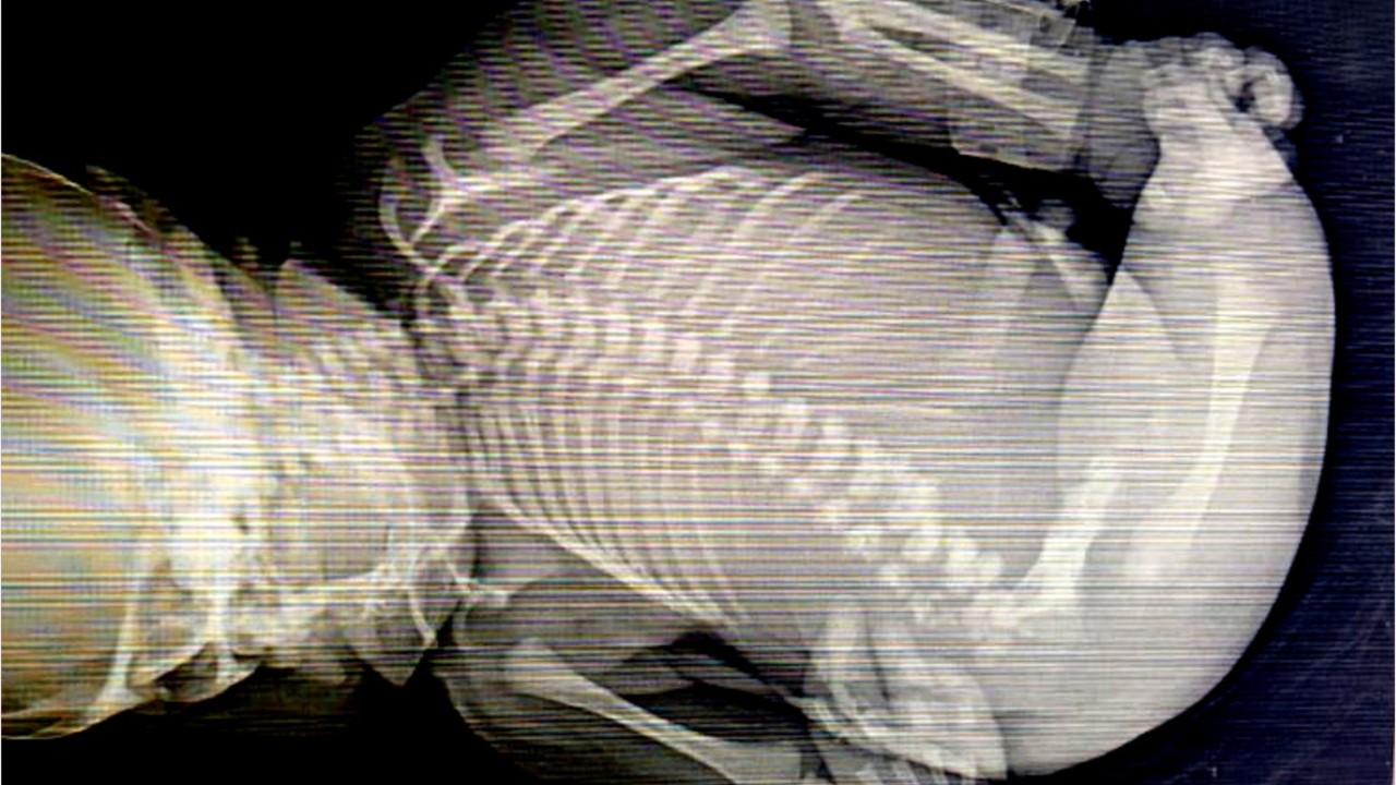 Baby with 'mermaid syndrome' dies minutes after birth
