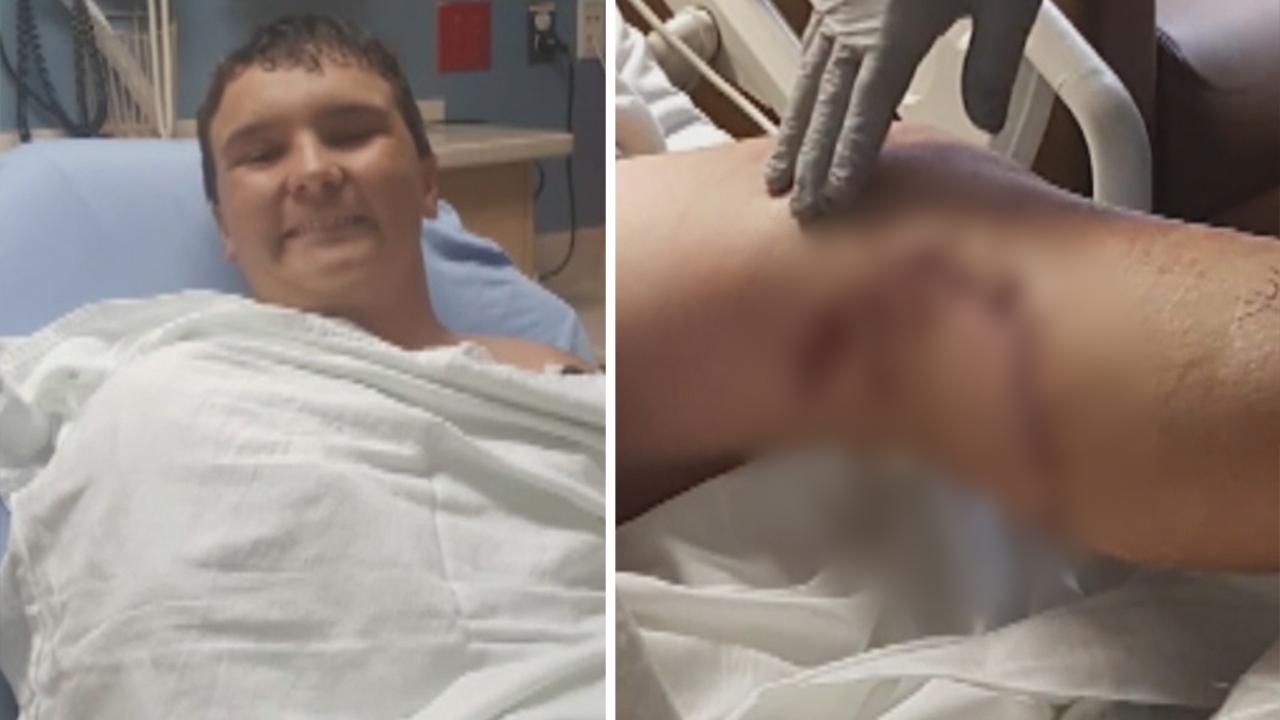 Shark attack victim wants to go on with Disney vacation