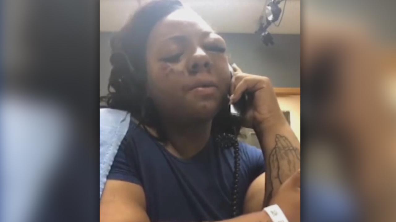 Police deny claims of beating up woman during arrest