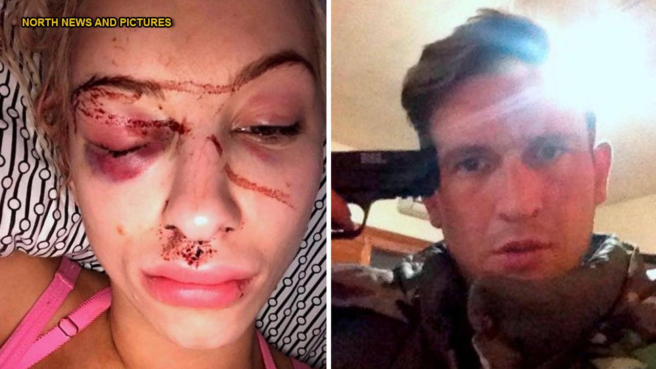 GRAPHIC PHOTO: Quick thinking model rescued by secret selfie
