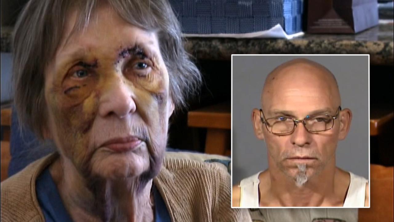 80-year-old woman beaten, shot in face during home invasion