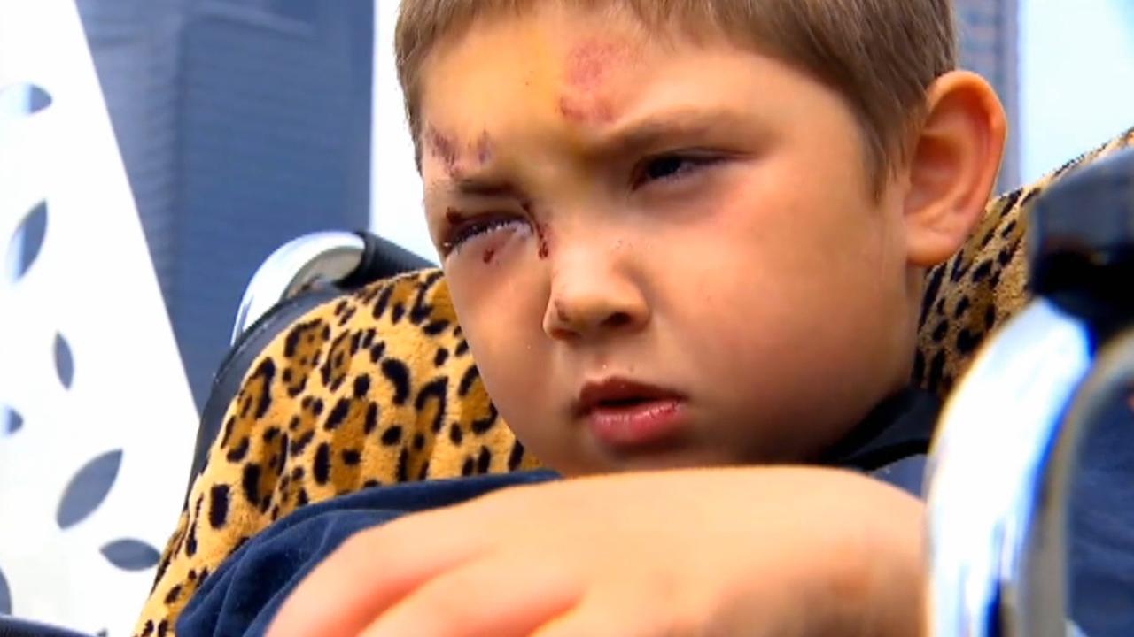 6-year-old beaten after standing up to bullies