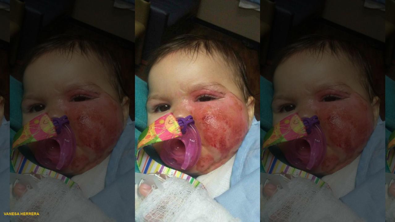 Infant suffers second-degree burns after pulling slow cooker off a counter
