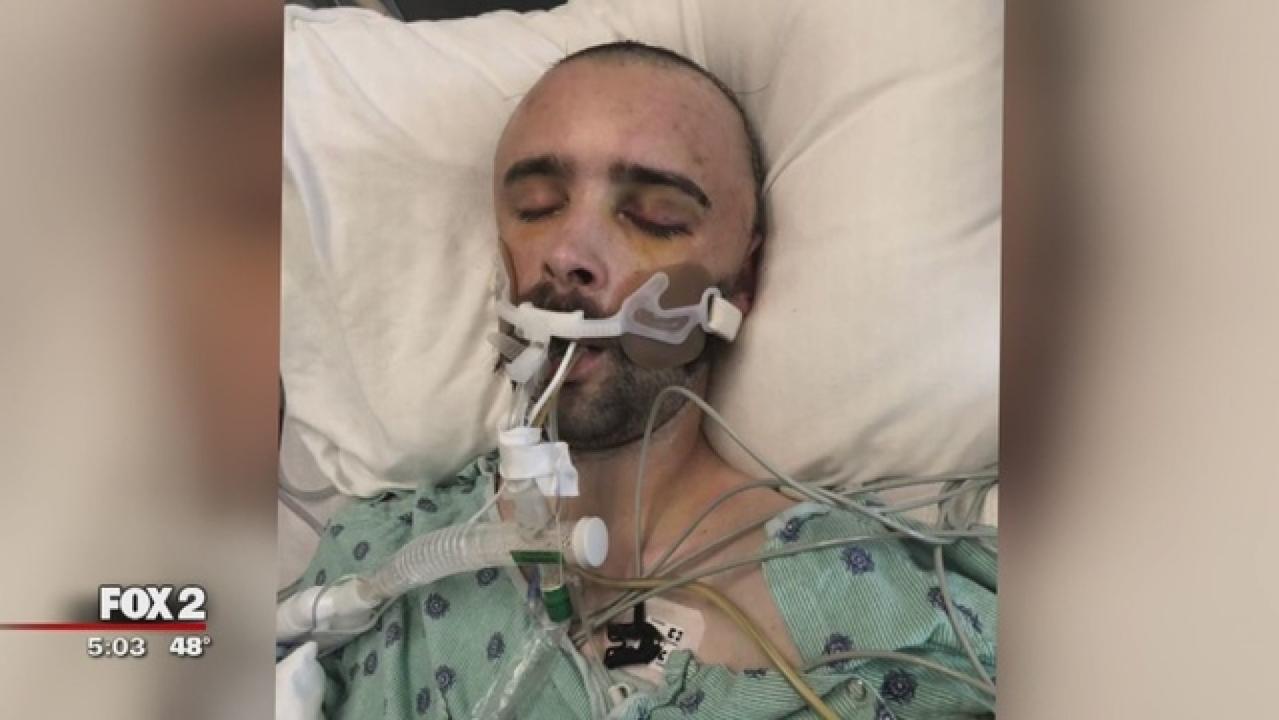 Man severely beaten while attending a bachelor party