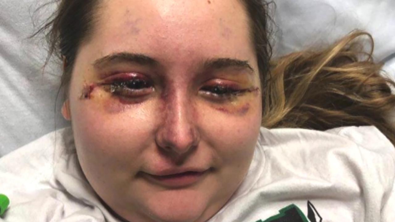 Missouri teen blinded by mystery illness