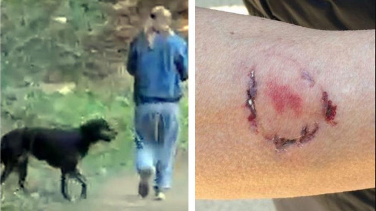 California woman arrested after biting jogger who pepper-sprayed her dog