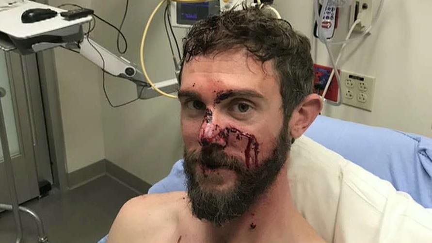 Colorado man speaks out about surviving mountain lion attack