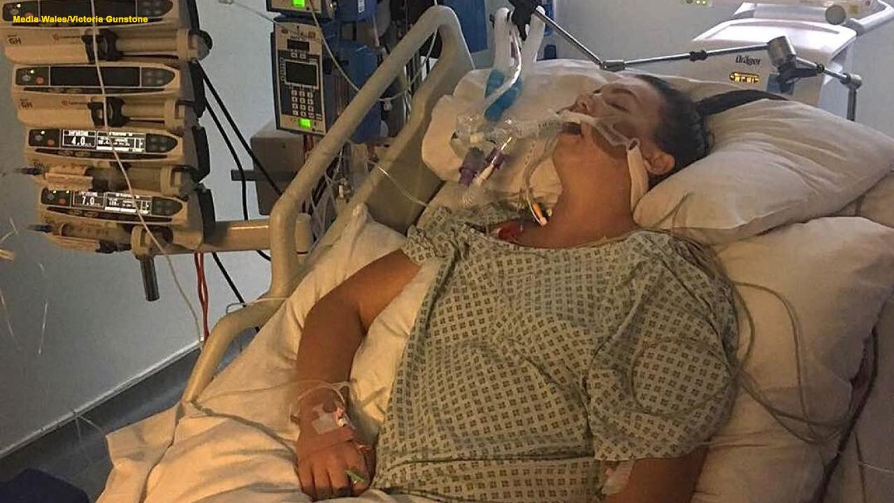 Newly engaged woman is given a 3 percent chance of survival after contracting double pneumonia and sepsis