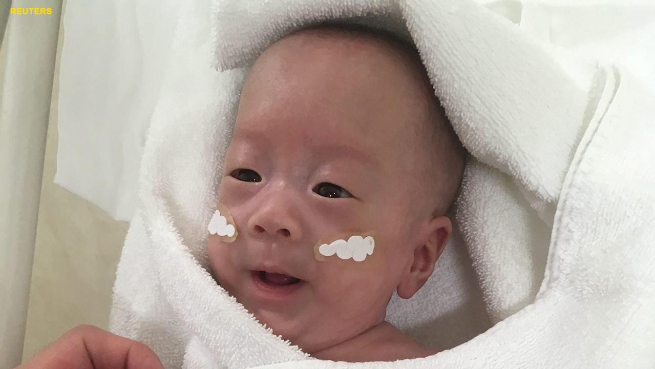 Tokyo boy believed to be world’s smallest surviving baby born at 24 weeks gestation