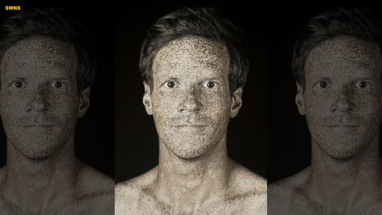 French photographer releases unique series of portraits that capture the real damage caused by UV rays