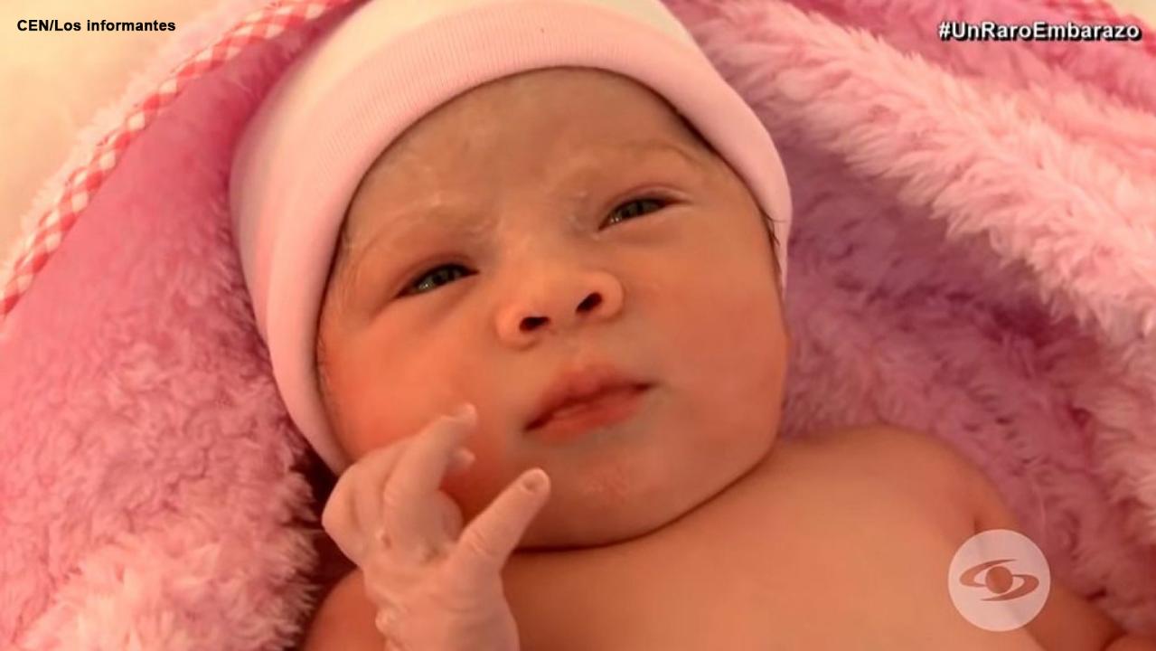 Baby born with twin growing inside her 