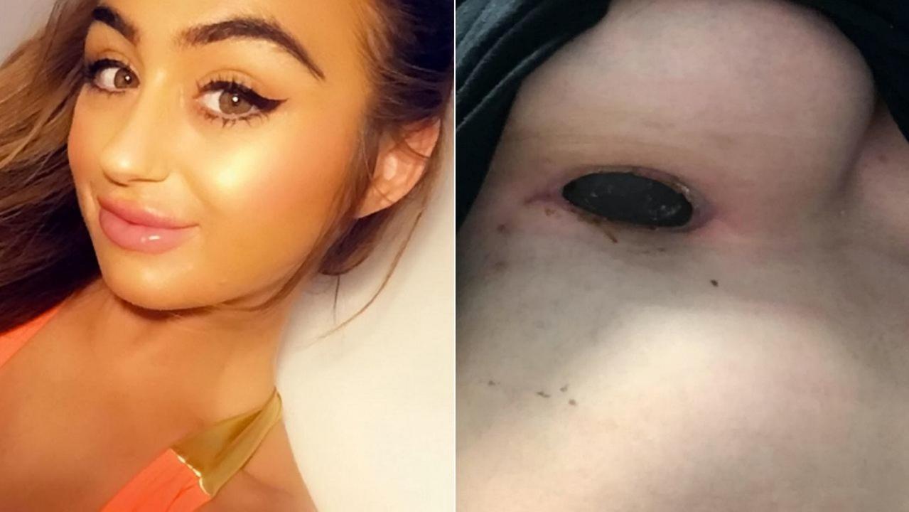 Woman claims implant scar smelled 'like rotten meat'