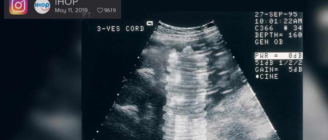 IHOP under fire for tweeting a sonogram image of pancakes inside a womb in honor of Mother’s Day