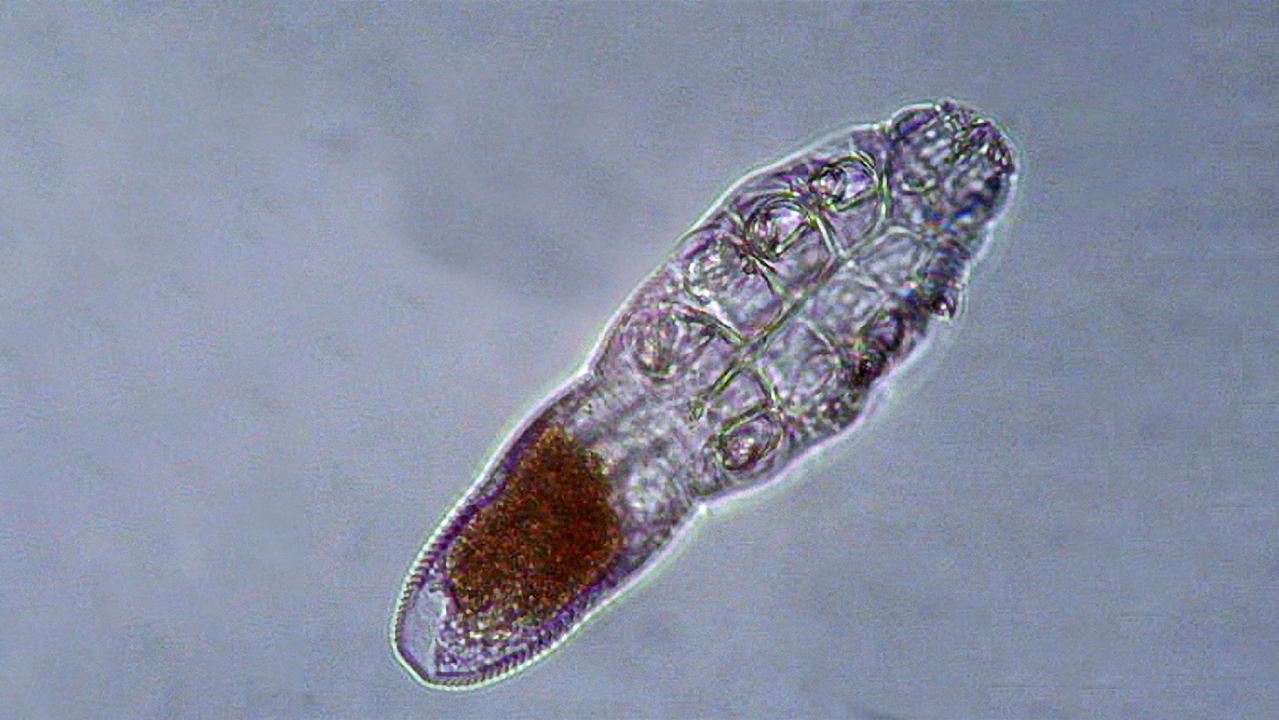 Face mites feast on skin oils while you sleep