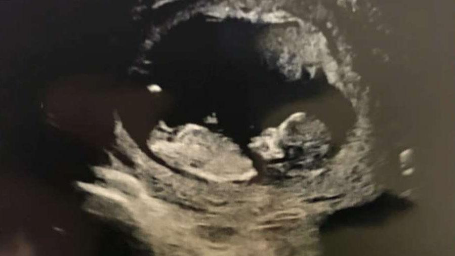Jedediah reveals the gender of her baby!