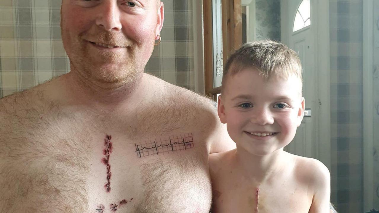 Dad gets 3.5-inch scar tattoo to match his son's life-saving heart surgery scar