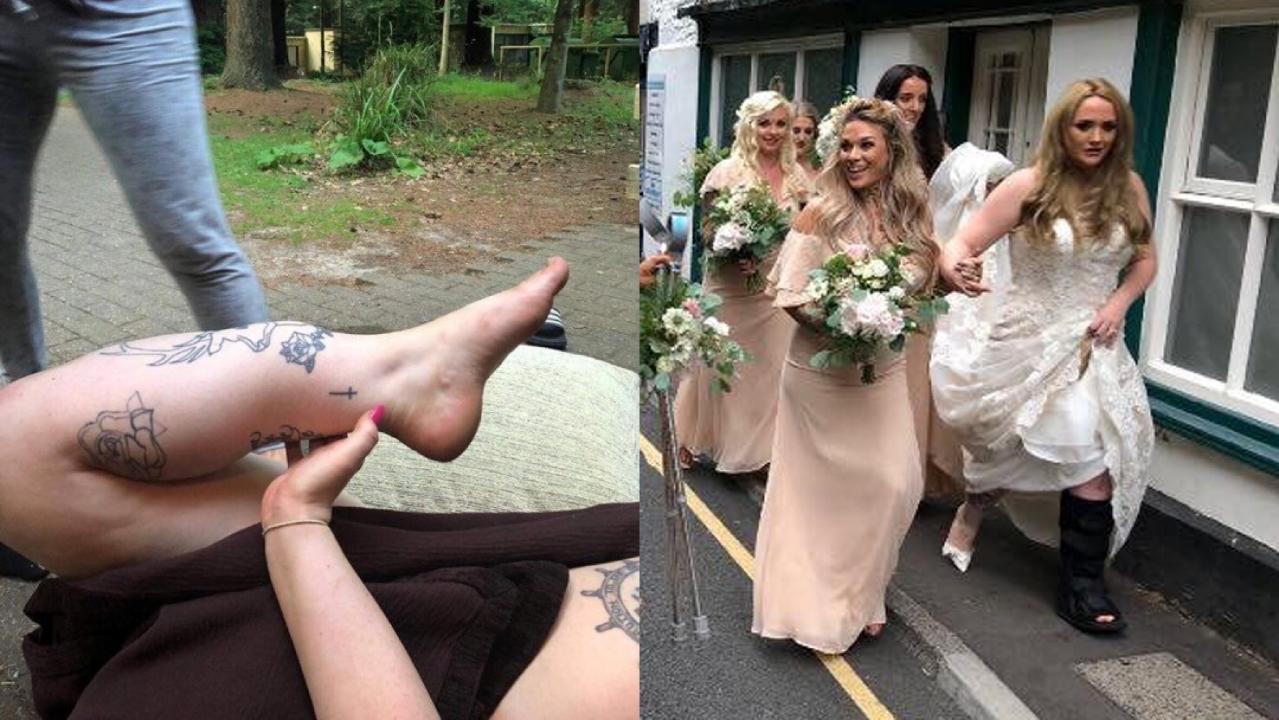Bride nearly loses leg after freak bachelorette party accident
