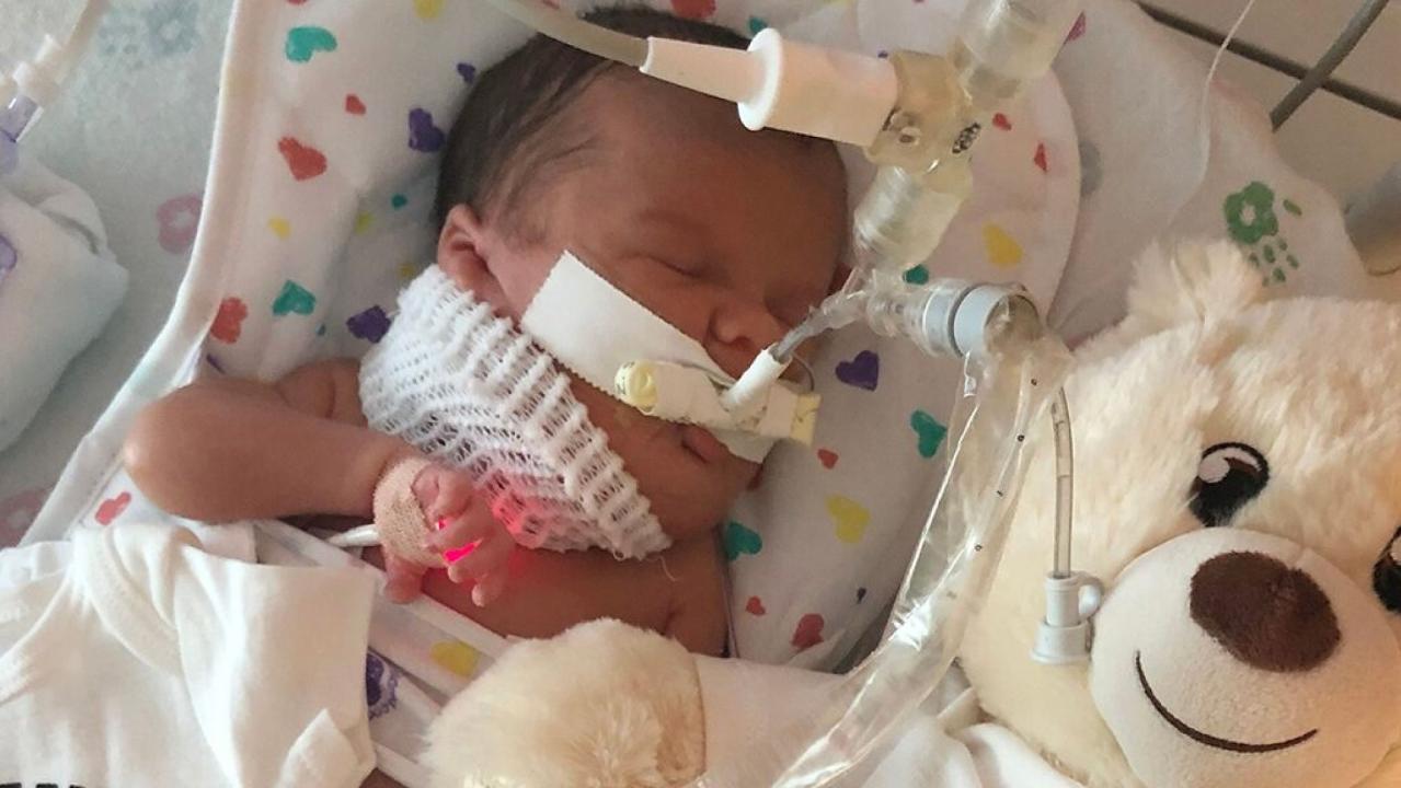 Illinois baby has 5-inch growth removed from neck hours after birth