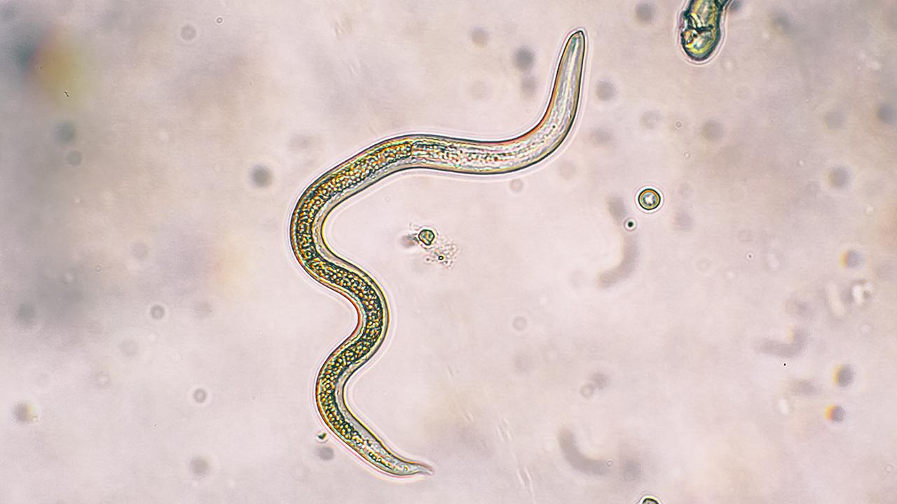  43-year-old man gets infected with a rare and dangerous parasite