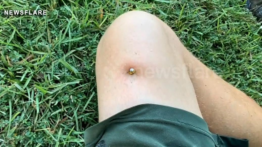 Georgia man shoots nail into thigh